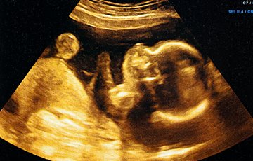 Baby Embryo Scientific Facts