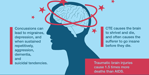 Concussion Infographic
