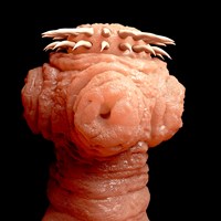 Human Parasite Facts
