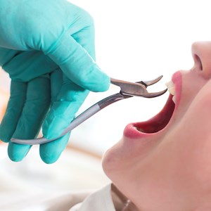 Facts about Dream Interpretations