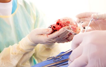 Heart Transplant Facts