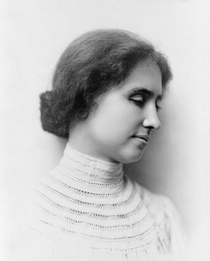 Helen Keller blindness