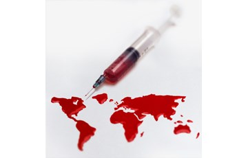 Interesting AIDS History Fact