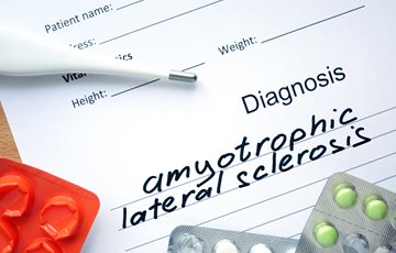 Interesting Lou Gehrig Disease Facts