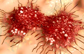 Interesting Cancer Statistics