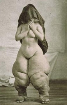 Strange Facts about Human Parasites