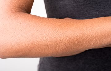 Interesting Goose Bump Fact