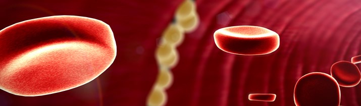 Interesting High Cholesterol Fact