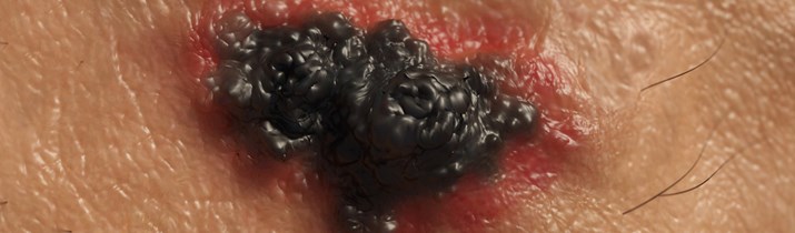 Interesting Tanning Fact