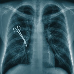 Interesting Medical Error Fact