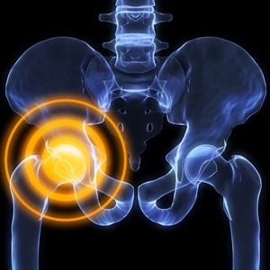 Interesting Osteoporosis Fact