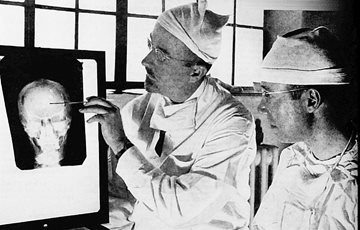 Interesting Lobotomy Fact