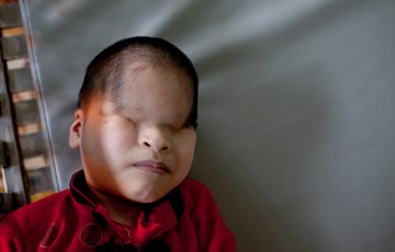 Vietnam Agent Orange