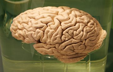 Cushing Brain Collection